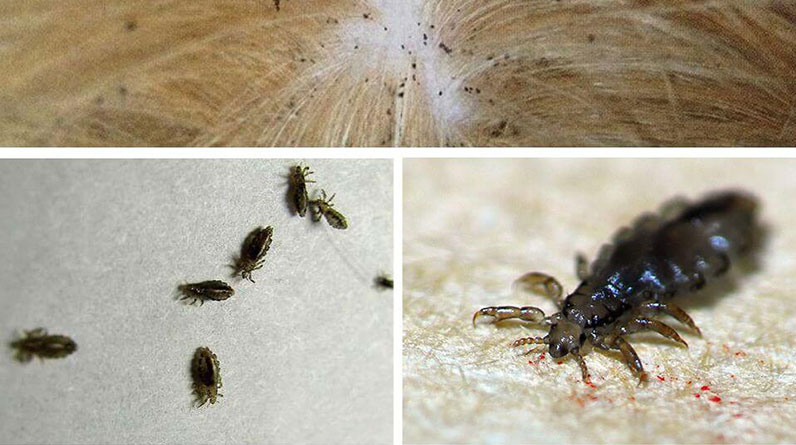 Bit temizlemenin doğal yolları nelerdir?